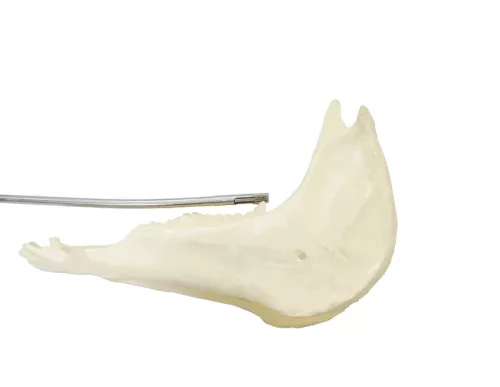 11s Handpiece - Convex